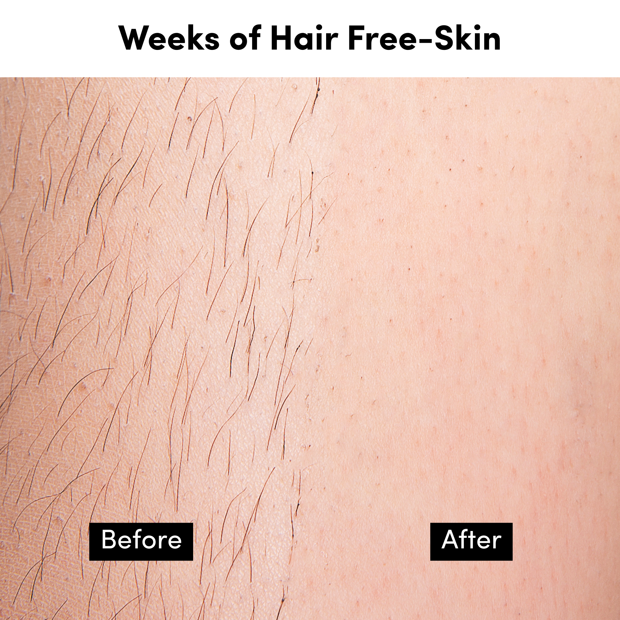 No-Strip Sugaring Paste - Image 4